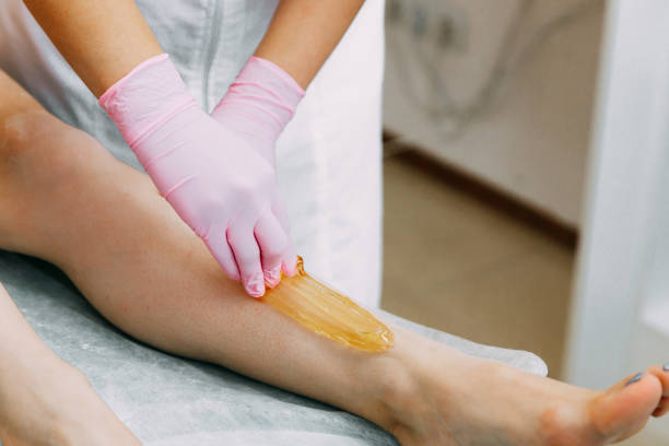 Application de la pâte de sucre sur la jambe